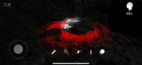 孙美琪疑案兰芝2025下载安装 孙美琪疑案兰芝2025下载安装