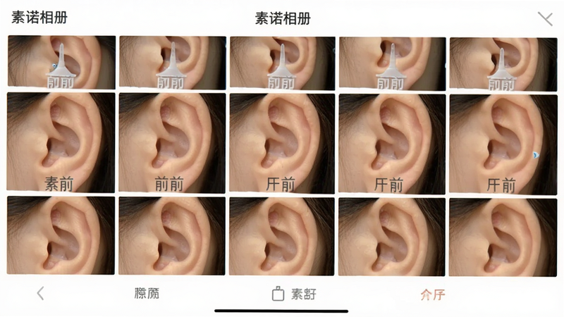 手机相册界面截图,显示多张耳道清洁前后的对比照片缩略图,排列整齐,顶部有“素诺相册”标题,底部有简单的操作按钮,界面干净,色调柔和,风格清新,无多余图标