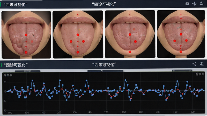 主体为舌象识别与脉象波形界面,布局上下分布,上为舌象对比图,下为脉象曲线,排版紧凑,风格专业医疗UI,细节展示红色穴位标记与蓝色数据点,画质清晰,干净,无多余元素,文字“四诊可视化”加引号