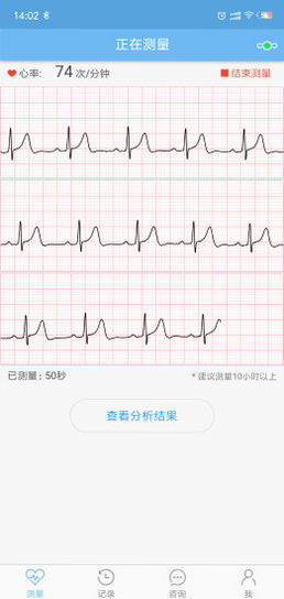 数维康心电 安卓版 功能截图