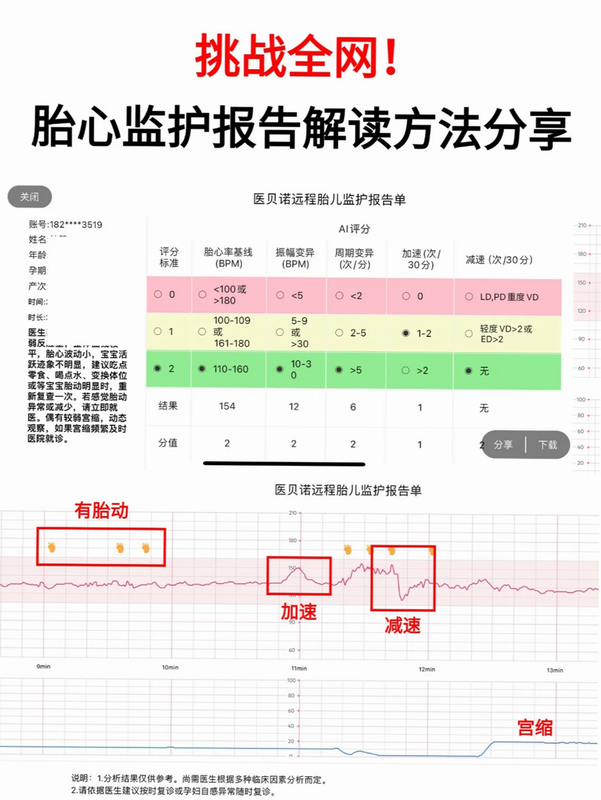 光佑健康 安卓版 胎心监护数据图表界面