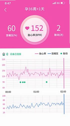 乖乖葆孕妇 安卓版 胎心监护功能界面截图