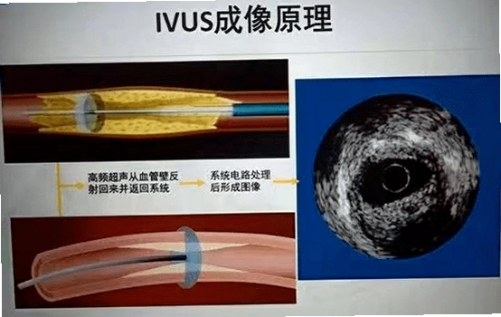 ��ʵ����ģ��3D��ͼ3